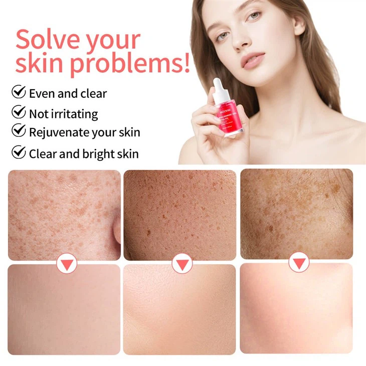 OEM Niacinamide 10%+Txa 4% Reduce Wrinkles Shrink Pores MOOYAM Serum high quality