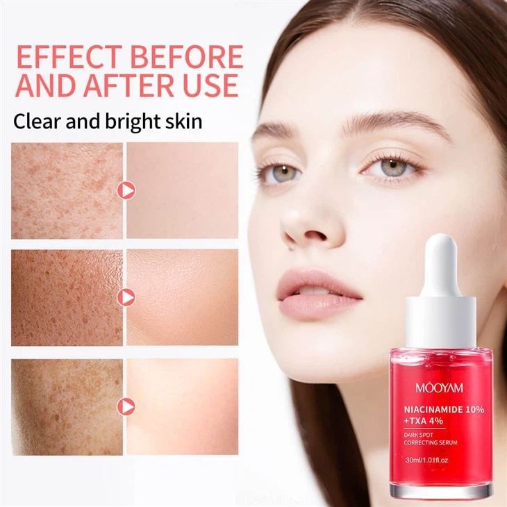 OEM Niacinamide 10%+Txa 4% Reduce Wrinkles Shrink Pores MOOYAM Serum factory